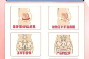 产后肚子松弛怎么办能恢复吗（产后肚子变松能恢复吗）