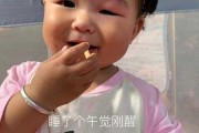 宝宝眼睛被蚊子咬肿了怎么快速消除（宝宝眼睛被蚊子咬肿了怎么办才能消肿止痛）