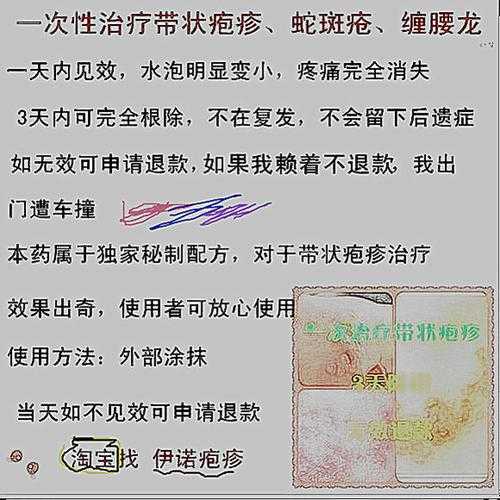 蛇斑癣的治疗方法（蛇斑疮有什么好办法治疗）