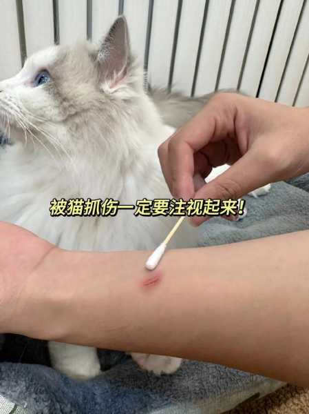 被猫狗咬伤怎么办?（被猫狗咬伤怎么办没有出血）