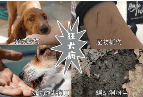 狂犬病有什么临床症状（狂犬病的临床症状）